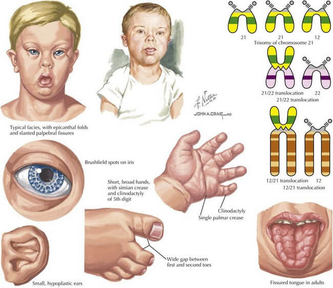 21-maart-downsyndroomdag-stvs