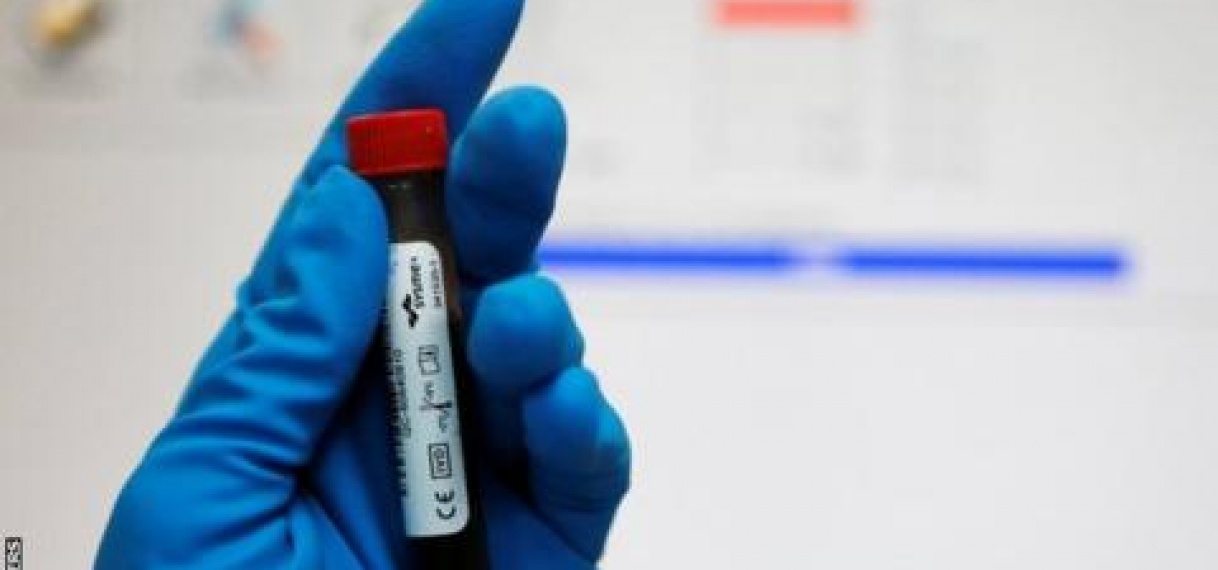 SVB geeft inhoud aan Anti Doping testen