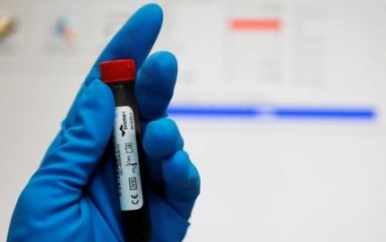 SVB geeft inhoud aan Anti Doping testen