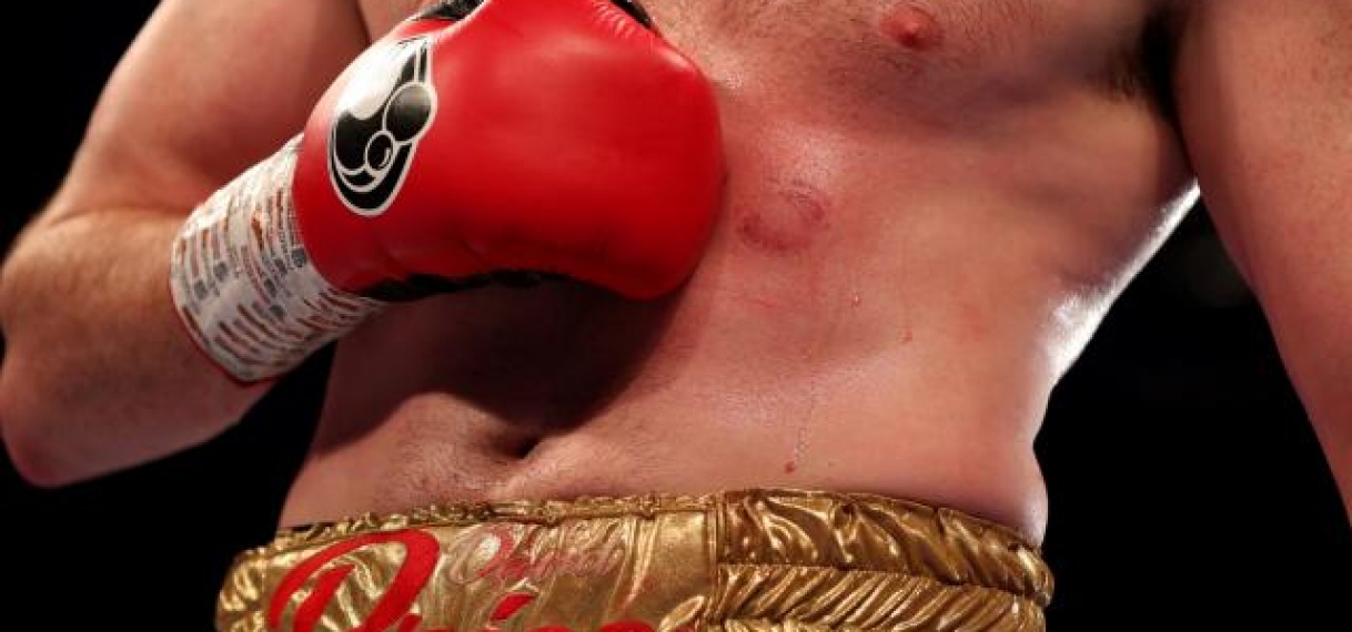 Bijtende bokser Kash Ali raakt licentie voorlopig kwijt