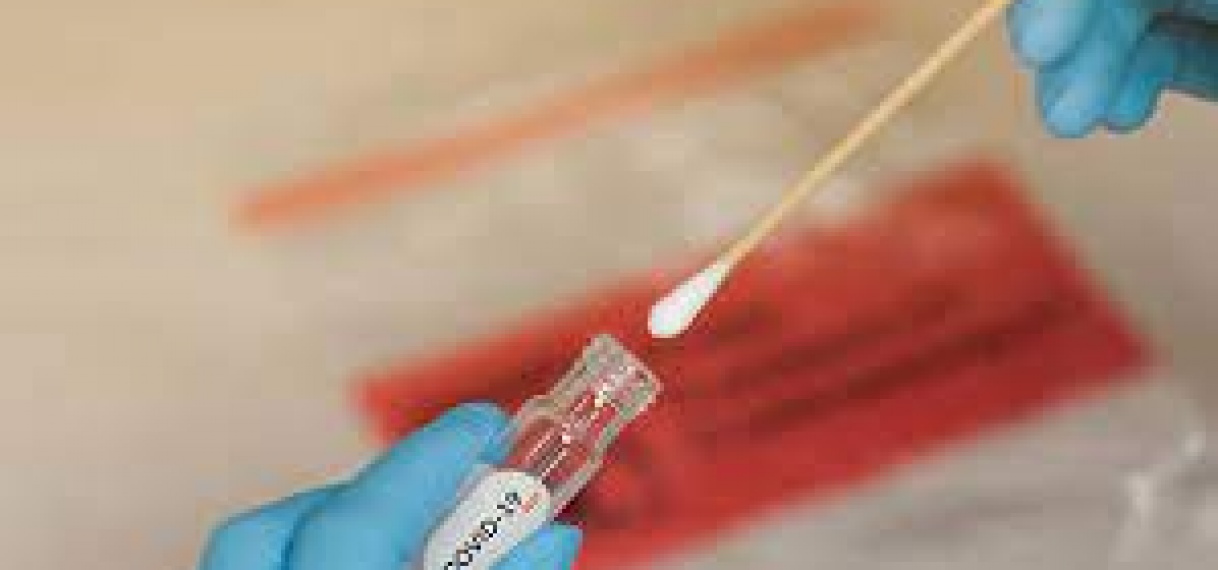 Covid-19-swab test blijven doen om verspreiding te voorkomen