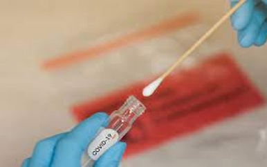 Covid-19-swab test blijven doen om verspreiding te voorkomen