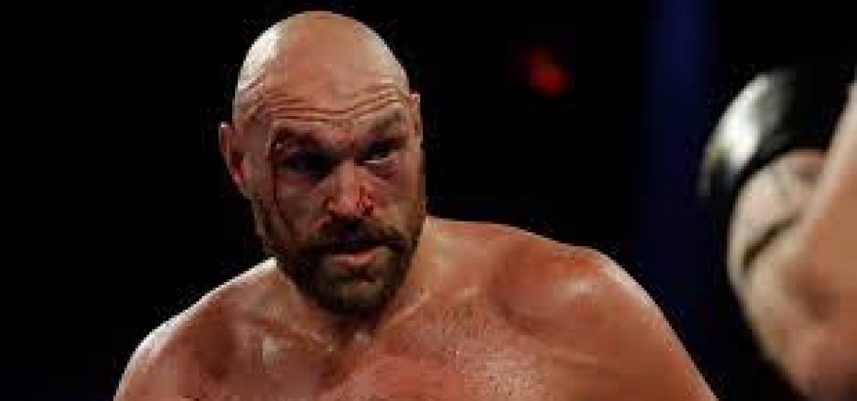 Tyson Fury biedt Anthony Joshua 20 miljoen voor gevecht met blote vuist