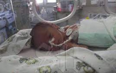 Jaarlijks veel vroeggeboren kinderen in Suriname