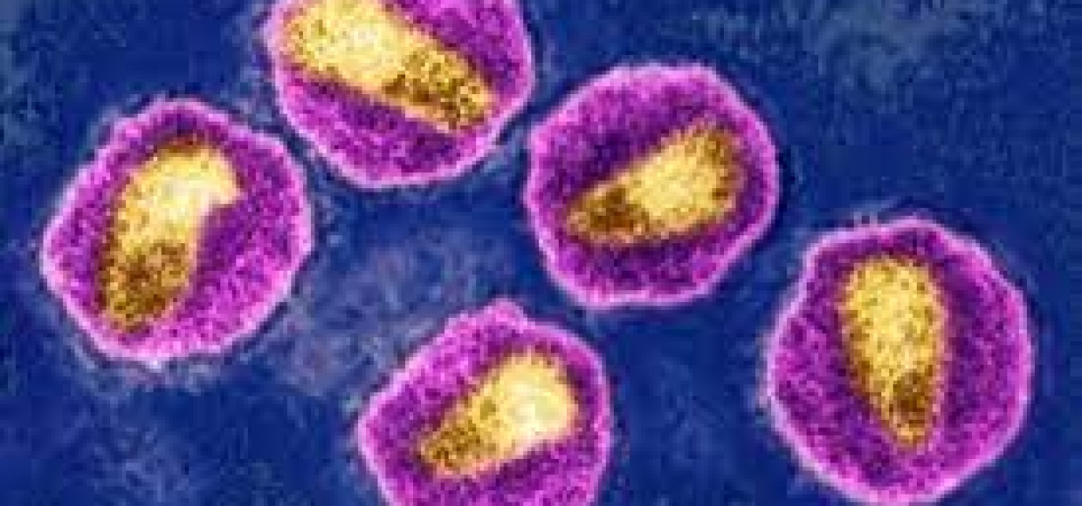 Agressieve hiv-variant ontdekt in Nederland en België