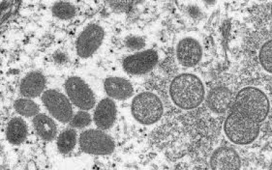 Apenpokkenvirus rukt gestaag op in Europa, viroloog maakt zich zorgen
