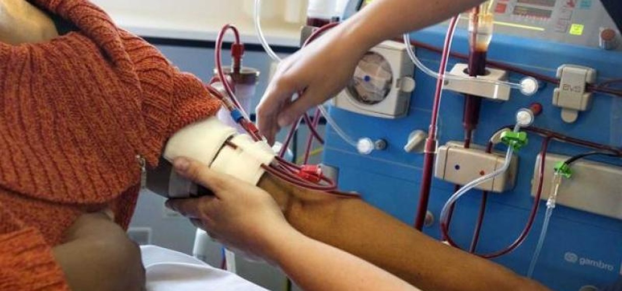 Vergoeding voor nierdialyse behandelingen