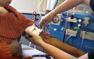 Vergoeding voor nierdialyse behandelingen