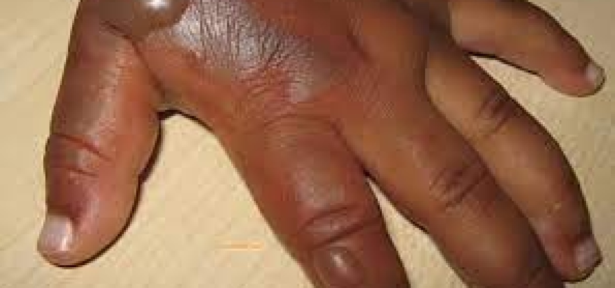 [UPDATEN] moeder die 8-jarige zoon brandwonden toebracht, vrijgelaten