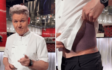 Gordon Ramsay laat verwondingen zien na fietsongeluk