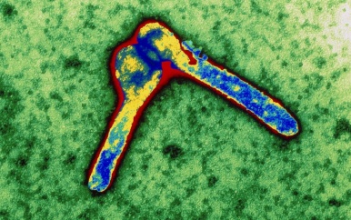 Acht doden in Tanzania, vermoedelijk door zeldzaam marburgvirus