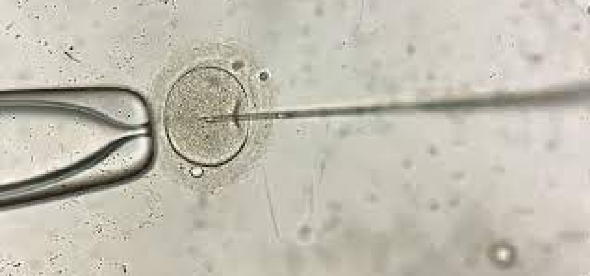 Wetenschappers maken eerste embryo’s van kangoeroes met ivf-behandeling