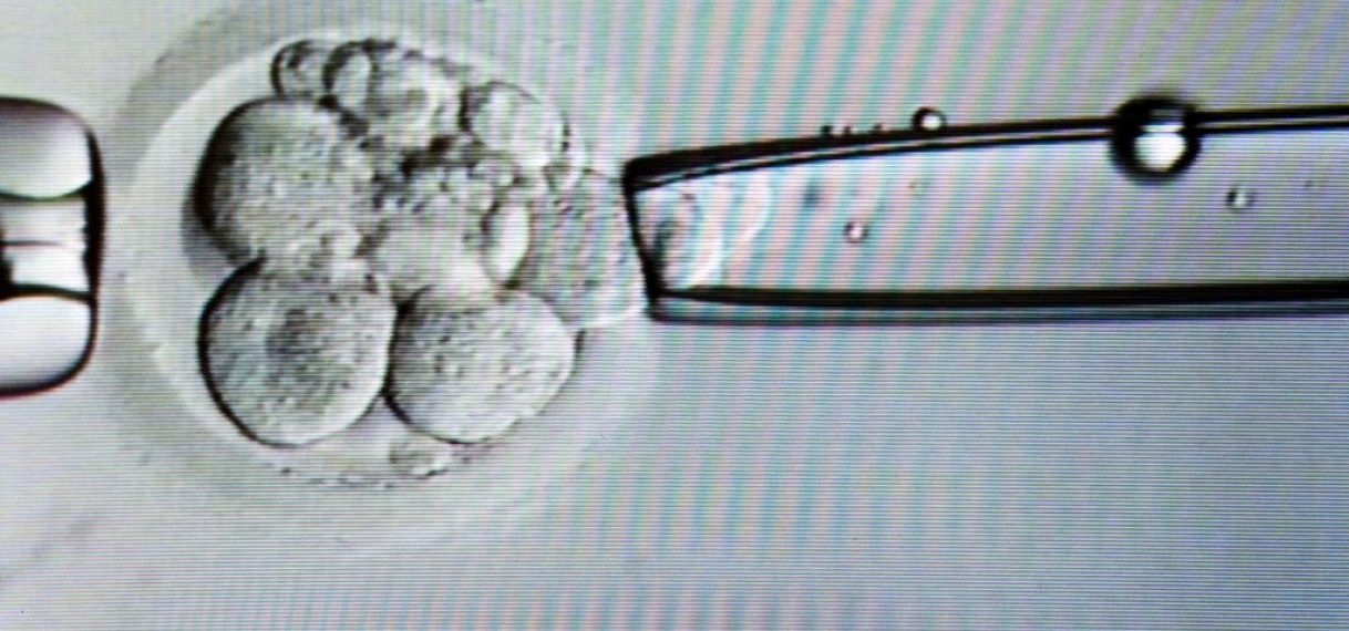 Voorstel om embryo’s te kweken voor onderzoek verdeelt Tweede Kamer