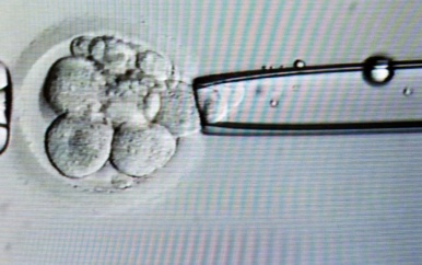 Voorstel om embryo’s te kweken voor onderzoek verdeelt Tweede Kamer