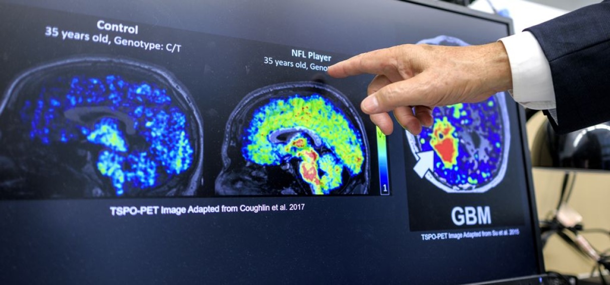 AI-tool voorspelt ziekten: ‘Het risico is dat we het verkeerd interpreteren’