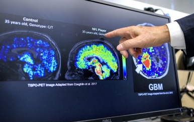 AI-tool voorspelt ziekten: ‘Het risico is dat we het verkeerd interpreteren’