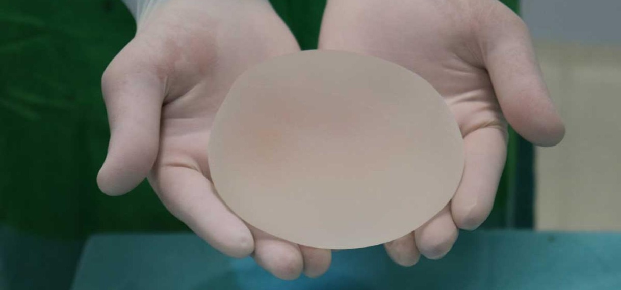 Massaclaim tegen farmaceut: 60.000 vrouwen eisen schadevergoeding om borstimplantaten