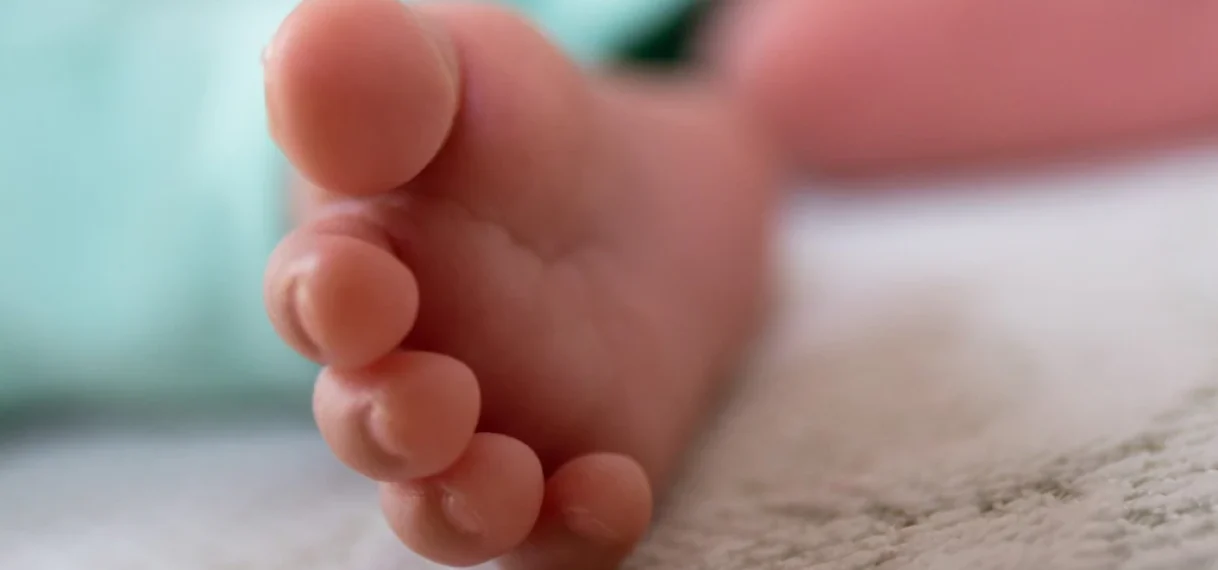 Artsen verwijderen twee foetussen uit buik van baby in India