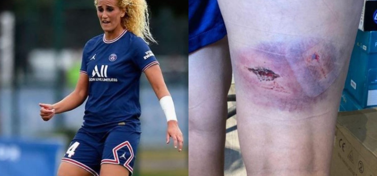 Voetbalster eist miljoenen van PSG na aanval en pestgedrag
