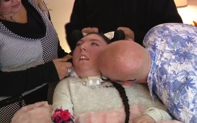 Vrouw zonder hersenen viert 20ste verjaardag: ‘Een mirakel’