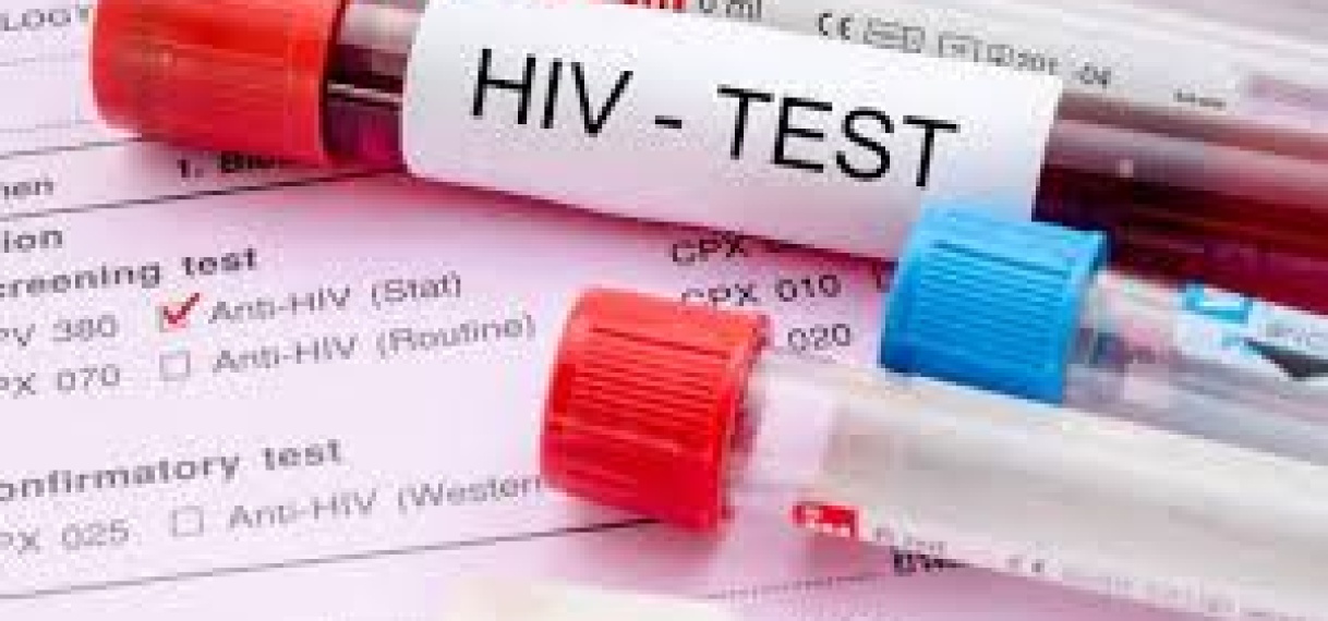 Toename hiv-gevallen onder jongeren en kwetsbare groepen