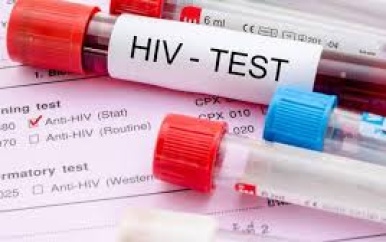 Toename hiv-gevallen onder jongeren en kwetsbare groepen