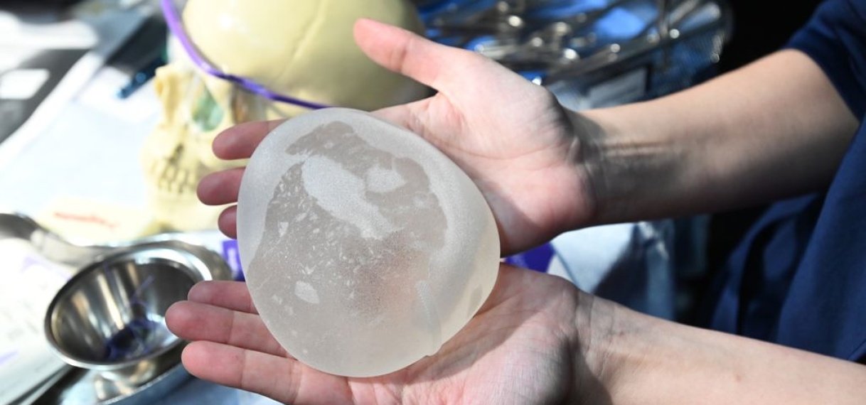 Hoger beroep in zaak rond mogelijk schadelijke borstimplantaten bij 60.000 vrouwen