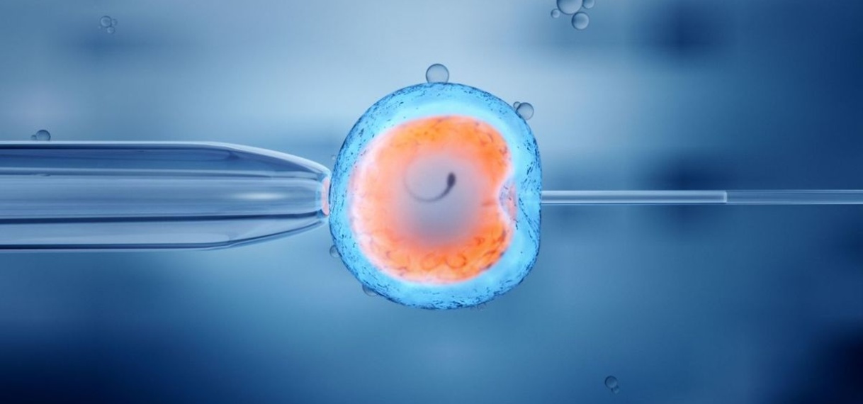 Ex-gynaecoloog gebruikte eigen zaad en verwekte minstens zestien kinderen