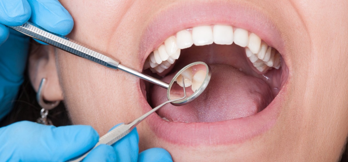 Patiënt overleden na tandartsbehandeling; onderzoek gestart