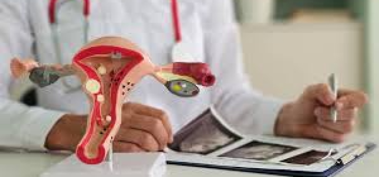 Hormonale aandoening PCOS krijgt nieuwe naam