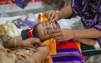 Dodental mazelen-uitbraak Bangladesh stijgt naar 750 kinderen