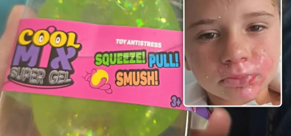 Frankrijk onderzoekt ontplofte squishy die kind verwondde
